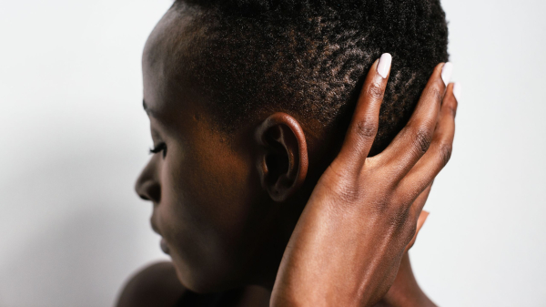 How to Take Care of Your Natural Hair If You Have Scalp Eczema
